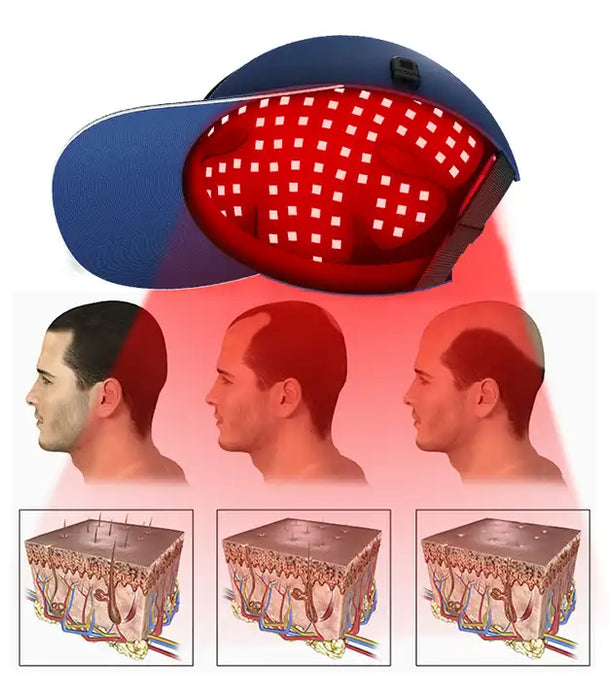 Led Red Light Helmet For Hair Regrowth