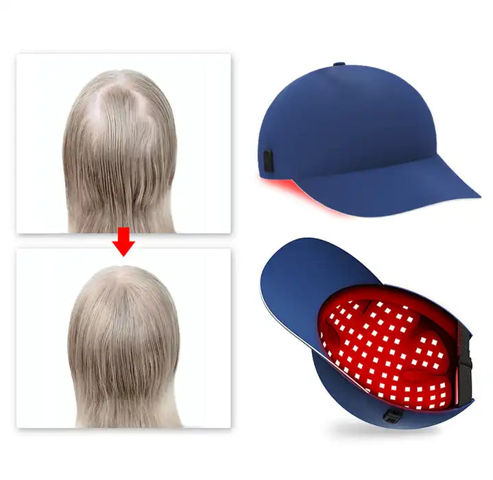 Led Red Light Helmet For Hair Regrowth